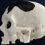 Cranio realizzato con la stampa 3D