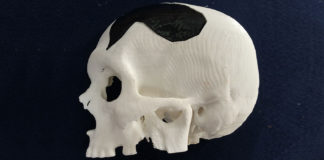Cranio realizzato con la stampa 3D