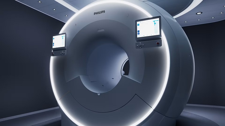 Philips i sistemi di diagnostica beneficiano dell'AI