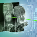 MIT-VolumeRegistration-01-press_0 (Credit: Courtesy of the researchers; MIT News)